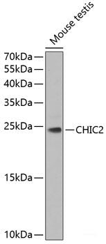 Immunohistochemistry of paraffin-embedded Rat spleen using SLC25A11 Polyclonal Antibody at dilution of 1:100 (40x lens).