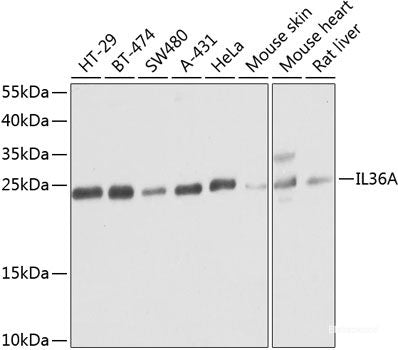 Immunohistochemistry of paraffin-embedded Mouse heart using HBA2 Polyclonal Antibody at dilution of 1:100 (40x lens).