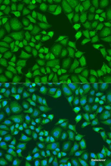 Immunofluorescence analysis of U2OS cells using BTG1 Polyclonal Antibody