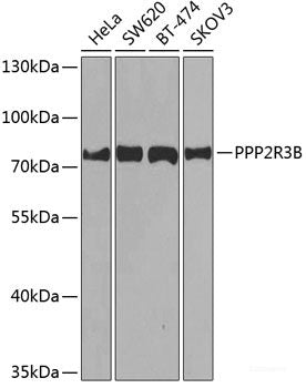 Western blot analysis of extracts of various cell lines using POMP Polyclonal Antibody at dilution of 1:3000.