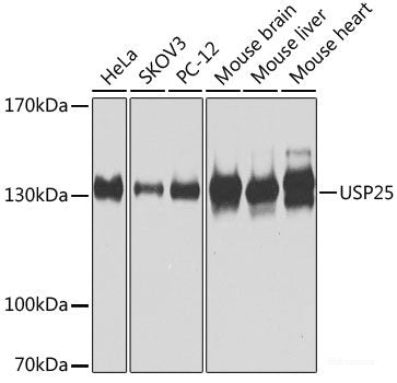 Western blot analysis of extracts of Mouse pancreas using SYNGR1 Polyclonal Antibody at dilution of 1:1000.