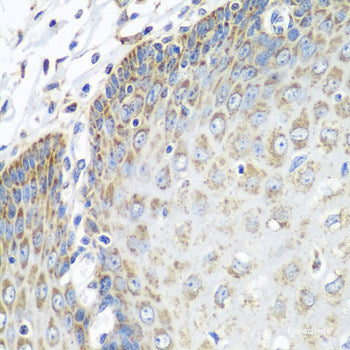 Western blot analysis of extracts of various cell lines using CTSH Polyclonal Antibody at dilution of 1:1000.