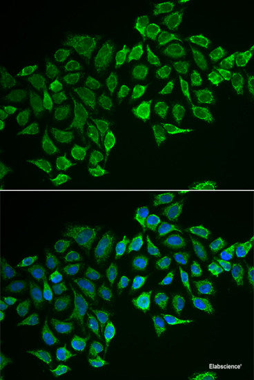 Immunohistochemistry of paraffin-embedded Human liver using IL20 Polyclonal Antibody at dilution of 1:100 (40x lens).