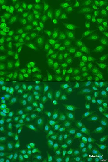 Western blot analysis of extracts of various cell lines using HK3 Polyclonal Antibody at dilution of 1:1000.