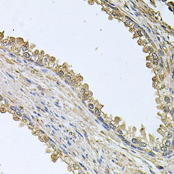 Western blot analysis of extracts of Mouse testis using SLC5A5 Polyclonal Antibody.