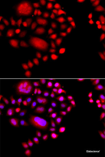 Immunofluorescence analysis of U2OS cells using ALOXE3 Polyclonal Antibody at dilution of 1:100. Blue: DAPI for nuclear staining.