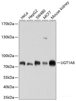 Western blot analysis of extracts of various cell lines using AKR1C2 Polyclonal Antibody at dilution of 1:1000.