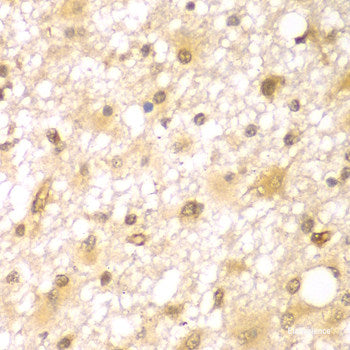 Immunofluorescence analysis of U2OS cells using SLC12A6 Polyclonal Antibody at dilution of 1:100. Blue: DAPI for nuclear staining.