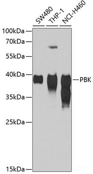 Immunohistochemistry of paraffin-embedded Rat liver using CUL4B Polyclonal Antibody at dilution of 1:200 (40x lens).