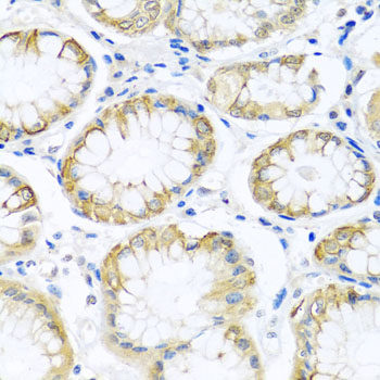 Confocal immunofluorescence analysis of U2OS cells using EBNA1BP2 Polyclonal Antibody at dilution of 1:200. Blue: DAPI for nuclear staining.