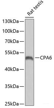 Western blot analysis of extracts of various cell lines using KYNU Polyclonal Antibody at dilution of 1:1000.