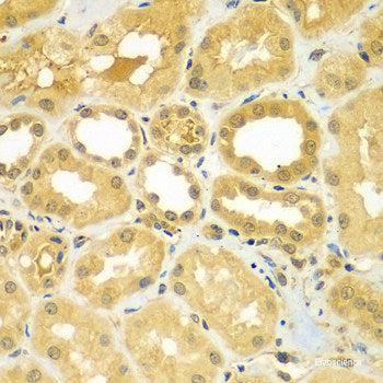 Immunofluorescence analysis of U2OS cells using AKR7A3 Polyclonal Antibody at dilution of 1:100. Blue: DAPI for nuclear staining.