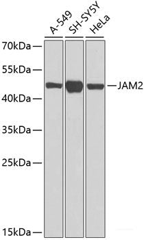 Western blot analysis of extracts of Jurkat cells using Phospho-eNOS(S1177) Polyclonal Antibody.