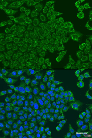 Western blot analysis of extracts of Rat brain using SLC22A2 Polyclonal Antibody at dilution of 1:1000.