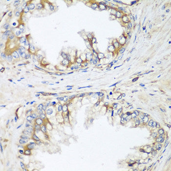 Western blot analysis of extracts of Rat brain using STX5 Polyclonal Antibody at dilution of 1:1000.