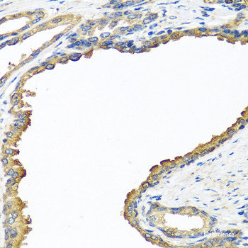Immunofluorescence analysis of A549 cells using NCALD Polyclonal Antibody
