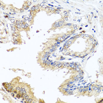 Immunofluorescence analysis of U2OS cells using DAPK2 Polyclonal Antibody at dilution of 1:100. Blue: DAPI for nuclear staining.