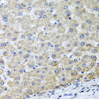Immunohistochemistry of paraffin-embedded Human prostate using HPSE2 Polyclonal Antibody at dilution of 1:100 (40x lens).