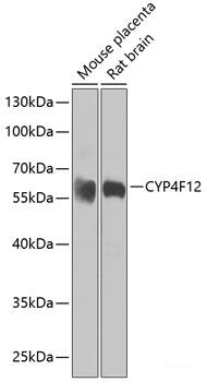 Western blot analysis of extracts of 22Rv1 cells using METTL7A Polyclonal Antibody at dilution of 1:1000.