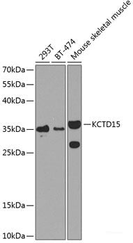 Western blot analysis of extracts of various cell lines using HIRA Polyclonal Antibody at dilution of 1:1000.