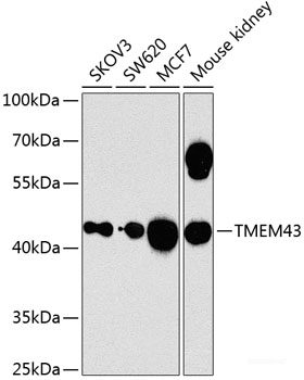 Western blot analysis of extracts of various cell lines using NPL Polyclonal Antibody at dilution of 1:3000.