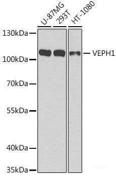Western blot analysis of extracts of various cell lines using ZC3HAV1 Polyclonal Antibody at dilution of 1:3000.
