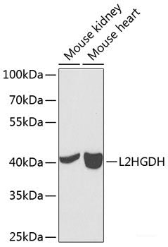 Immunohistochemistry of paraffin-embedded Human gastric using TAZ Polyclonal Antibody at dilution of 1:200 (40x lens).