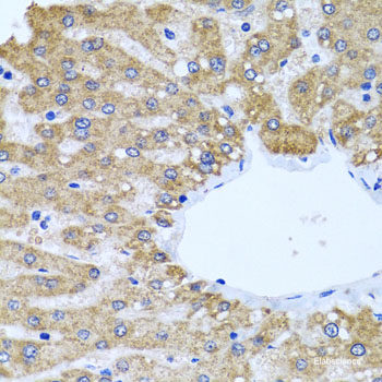 Immunofluorescence analysis of MCF-7 cells using PYGL Polyclonal Antibody