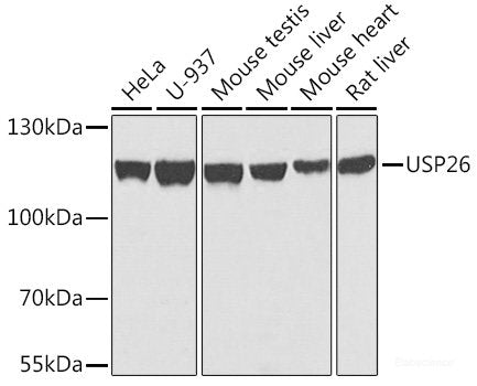 Western blot analysis of extracts of various cell lines using ARFGAP3 Polyclonal Antibody at dilution of 1:1000.