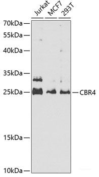 Immunofluorescence analysis of A549 cells using ORC6 Polyclonal Antibody