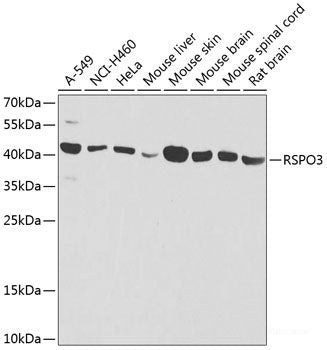 Immunohistochemistry of paraffin-embedded Mouse stomach using IER3 Polyclonal Antibody at dilution of 1:100 (40x lens).