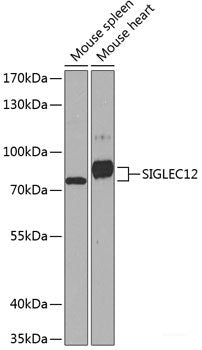 Western blot analysis of extracts of various cell lines using TOM1 Polyclonal Antibody at dilution of 1:3000.