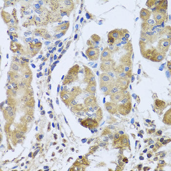 Immunohistochemistry of paraffin-embedded Human prostate using SOST Polyclonal Antibody at dilution of 1:100 (40x lens).