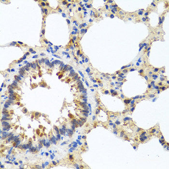 Immunofluorescence analysis of A549 cells using RRM2B Polyclonal Antibody