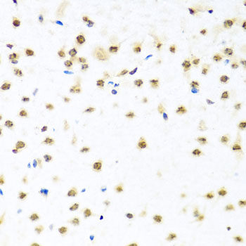 Immunohistochemistry of paraffin-embedded Rat lung using WNT5B Polyclonal Antibody at dilution of 1:100 (40x lens).