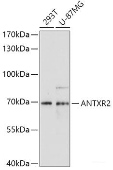 Western blot analysis of extracts of various cell lines using PDLIM1 Polyclonal Antibody at dilution of 1:1000.