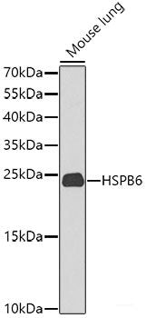 Western blot analysis of extracts from 293 cells using Phospho-NF-kB p65(S529) Polyclonal Antibody.