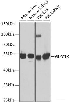 Immunofluorescence analysis of A549 cells using POLR1D Polyclonal Antibody