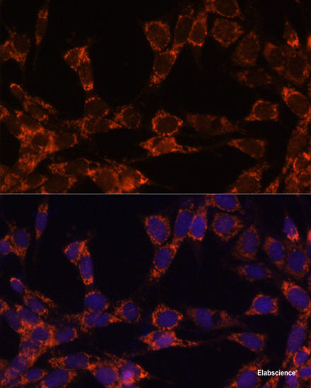 Western blot analysis of extracts of HeLa cells using NQO2 Polyclonal Antibody at dilution of 1:1000.