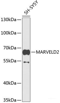Western blot analysis of extracts of Mouse kidney using ELP3 Polyclonal Antibody at dilution of 1:1000.