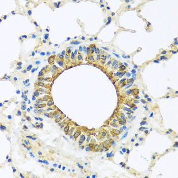 Immunohistochemistry of paraffin-embedded Mouse kidney using INADL Polyclonal Antibody at dilution of 1:100 (40x lens).