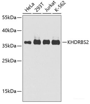 Western blot analysis of extracts of various cell lines using ARG2 Polyclonal Antibody at dilution of 1:1000.