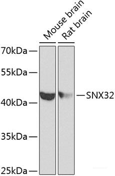 Immunohistochemistry of paraffin-embedded Human lung cancer using SEMA4C Polyclonal Antibody at dilution of 1:100 (40x lens).