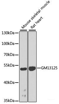 Immunohistochemistry of paraffin-embedded Human esophageal smooth muscle using MRPL12 Polyclonal Antibody at dilution of 1:100 (40x lens).