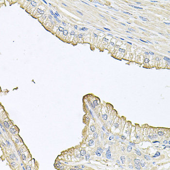 Western blot analysis of extracts of Jurkat cells using Phospho-MAPK3(T202) Polyclonal Antibody at dilution of 1:2000.