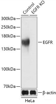 Immunohistochemistry of paraffin-embedded Rat liver using KAT2A Polyclonal Antibody at dilution of 1:100 (40x lens).