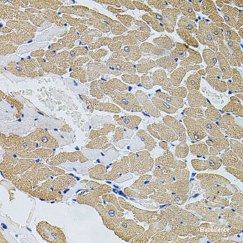 Immunofluorescence analysis of U-251MG cells using S100B Polyclonal Antibody at dilution of 1:100 (20x lens). Blue: DAPI for nuclear staining.