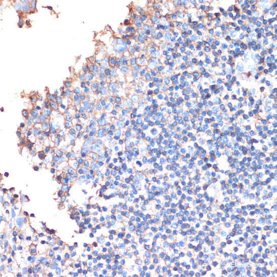 Immunohistochemistry of paraffin-embedded Rat heart using ARRB1 Polyclonal Antibody at dilution of 1:100 (40x lens).