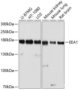 Western blot analysis of extracts of Mouse kidney using MEP1B Polyclonal Antibody at dilution of 1:1000.