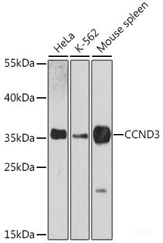 Immunofluorescence analysis of C6 cells using ADA Polyclonal Antibody at dilution of 1:100. Blue: DAPI for nuclear staining.